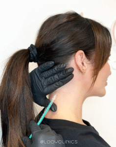 Botoxinjecties tegen migraine